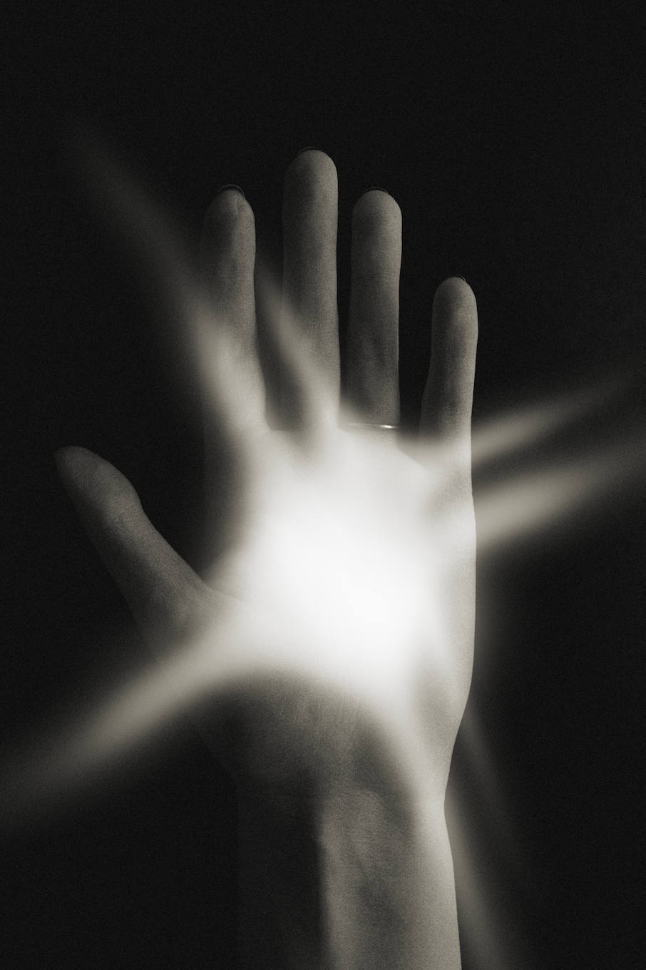 What to do after an acupuncture treatment